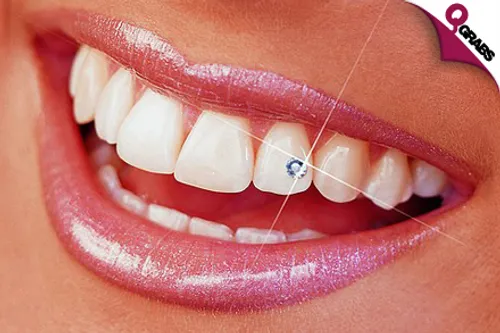 For QR350, Add a glamorous touch to your smile this summer with sparkling tooth jewelry PLUS scaling and polishing (QR900 value)